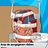 Operate Now: Heart Surgery